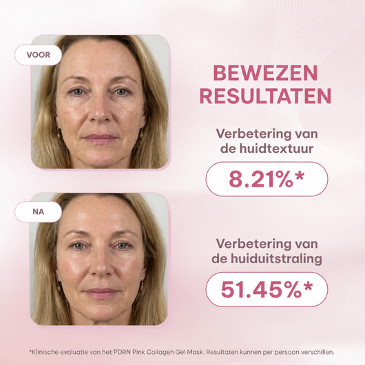 Collageen PDRN Mask